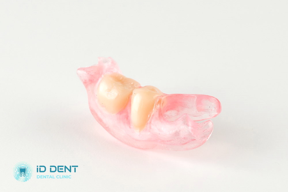  Іммедіат-протез зубів