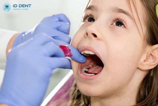 Исправление искривленного зубного ряда у детей с помощью пластинки