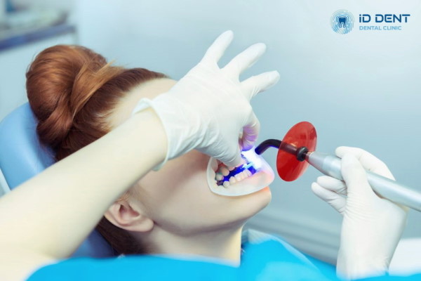 Процес відбілювання зубів лазером