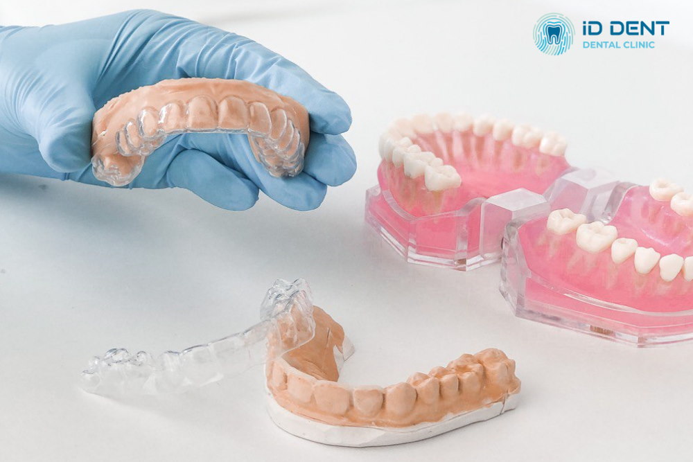 Férulas para la alineación dental (alineadores)