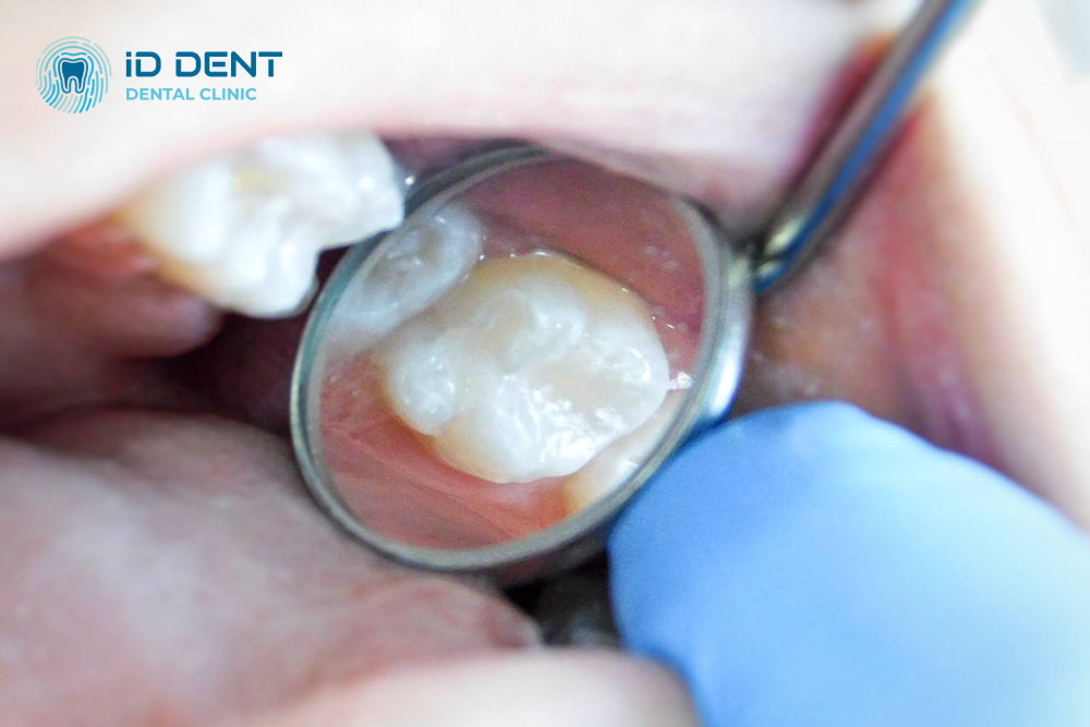 After Dental treatment