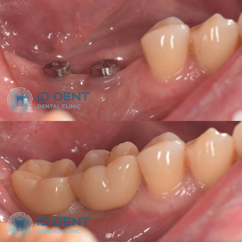 Odontólogo general; odontólogo prostodoncista Aghabekyan Andranik Vachikovich