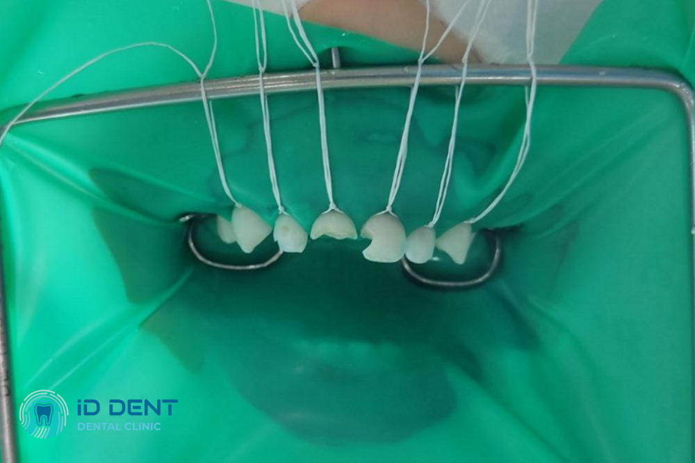 Antes Odontología pediátrica