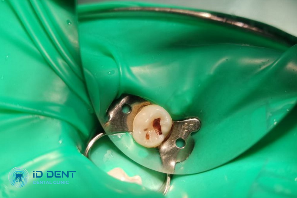 Antes Odontología pediátrica