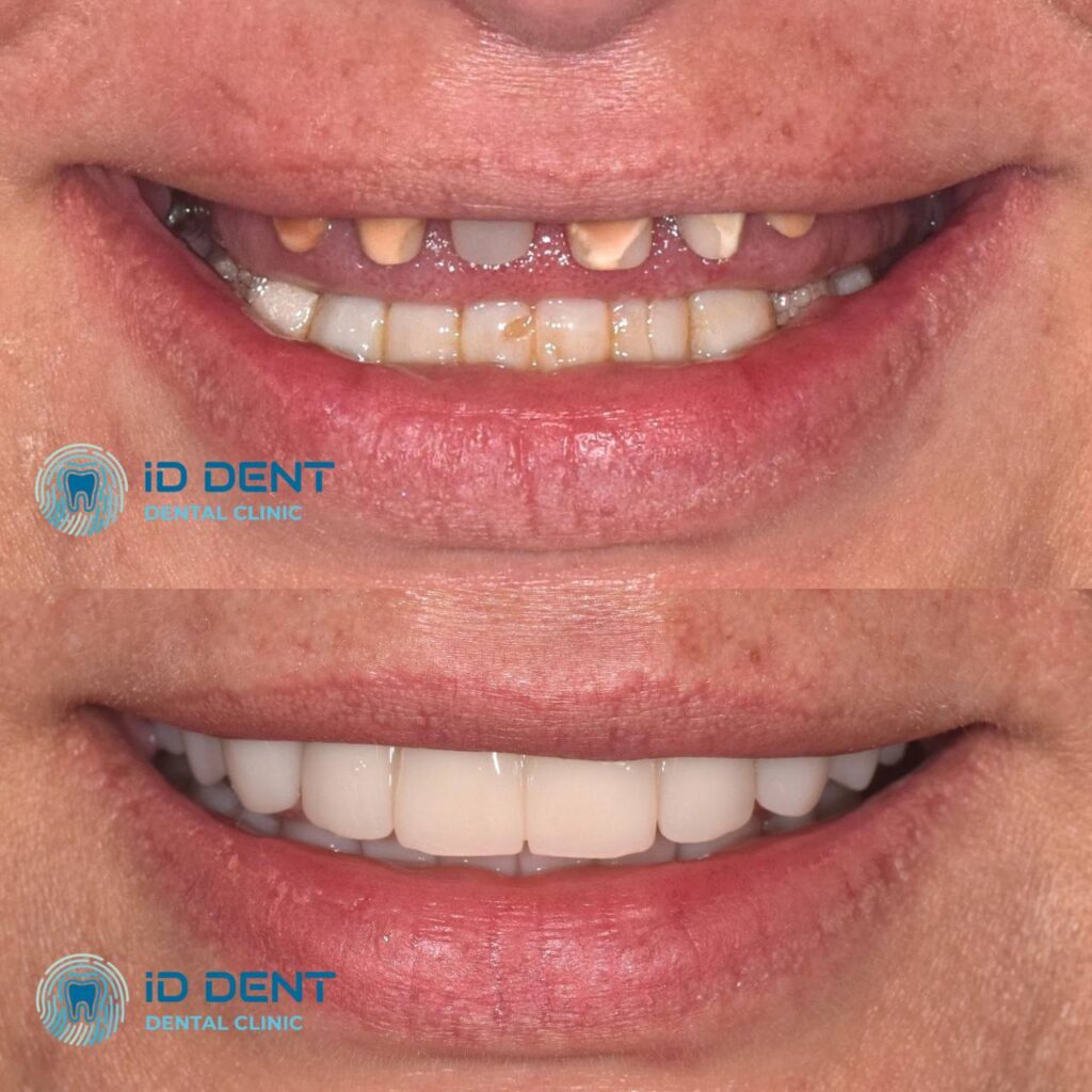 Odontólogo general; odontólogo prostodoncista Aghabekyan Andranik Vachikovich