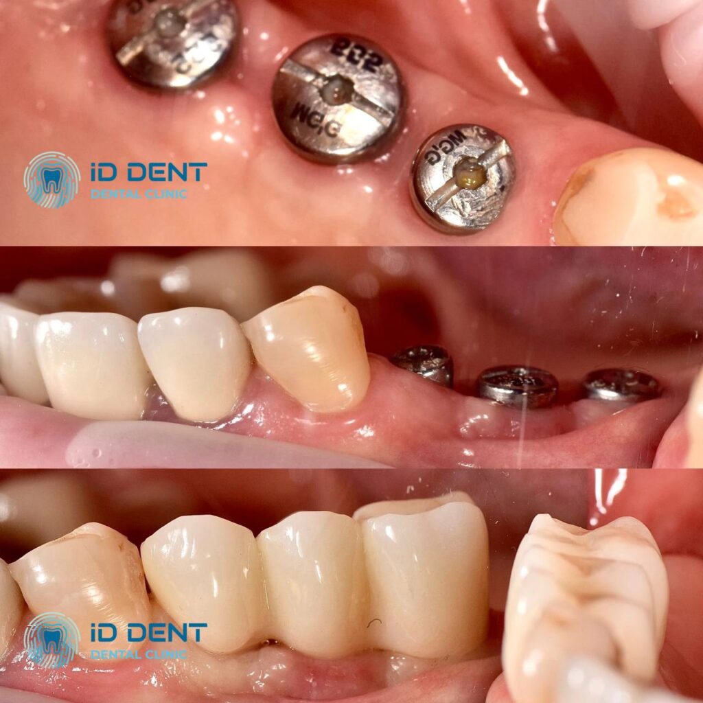 Odontólogo general; odontólogo prostodoncista Aghabekyan Andranik Vachikovich