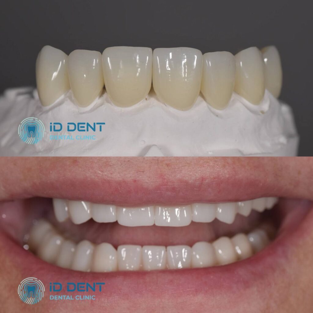 Odontólogo general; odontólogo prostodoncista Aghabekyan Andranik Vachikovich