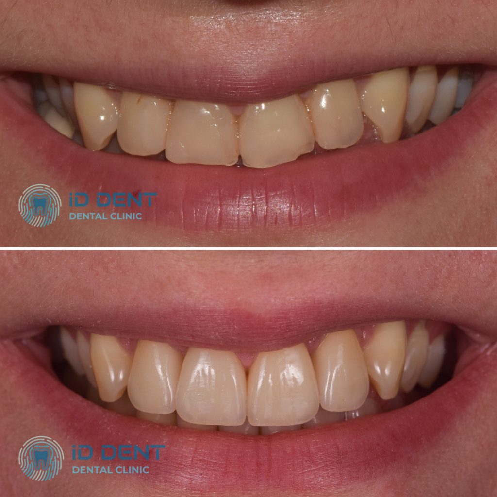 Odontólogo general; odontólogo prostodoncista Aghabekyan Andranik Vachikovich