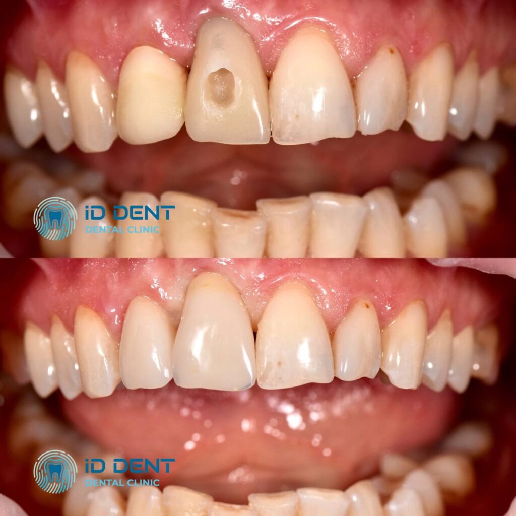 Odontólogo general; odontólogo prostodoncista Aghabekyan Andranik Vachikovich