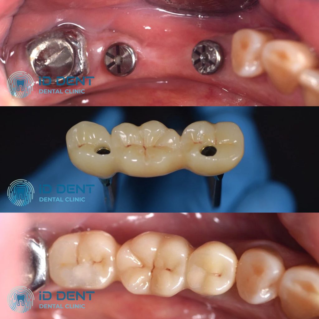 Odontólogo general; odontólogo prostodoncista Aghabekyan Andranik Vachikovich