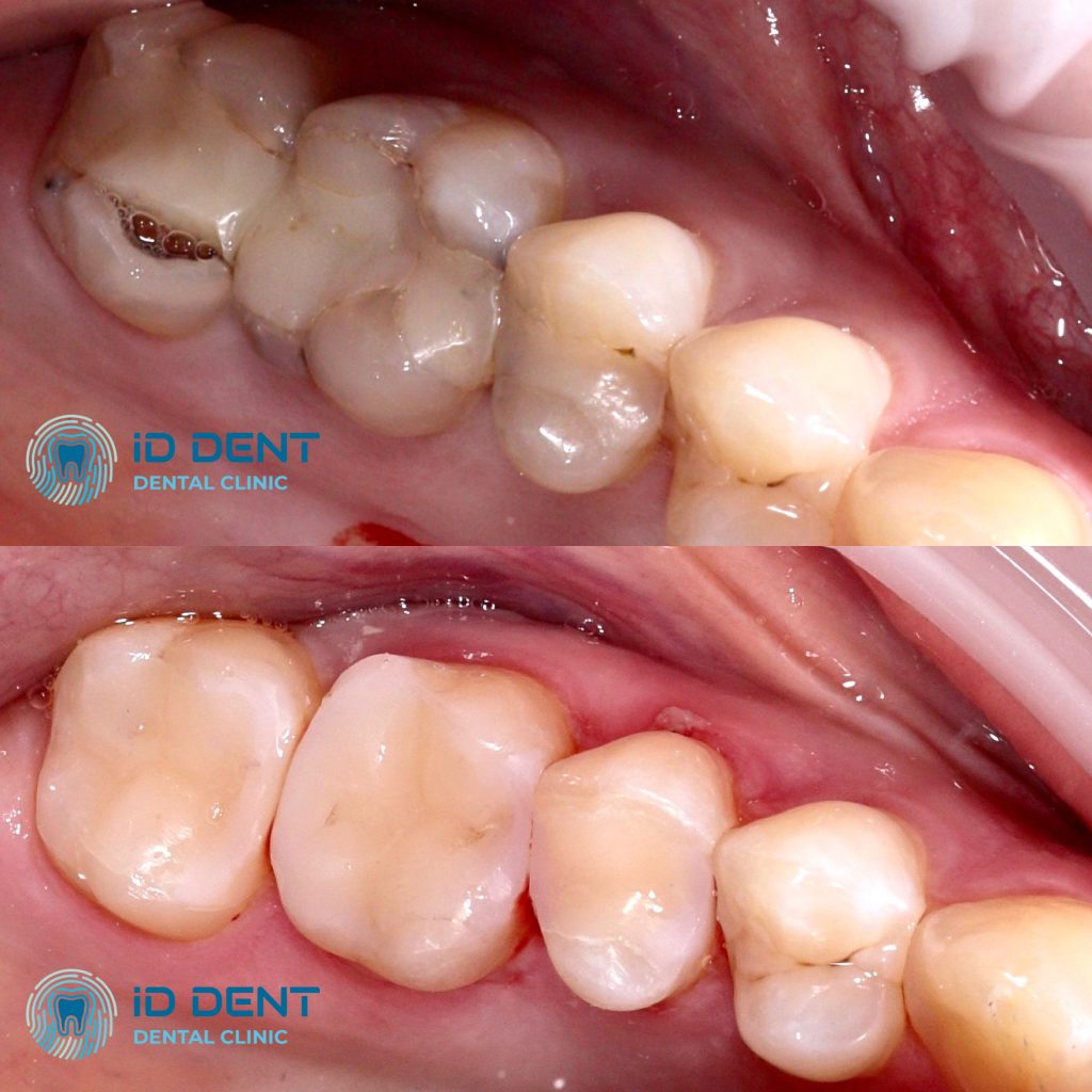 odontólogo general; cirujano dentista Parmenov Oleg Vladimirovich