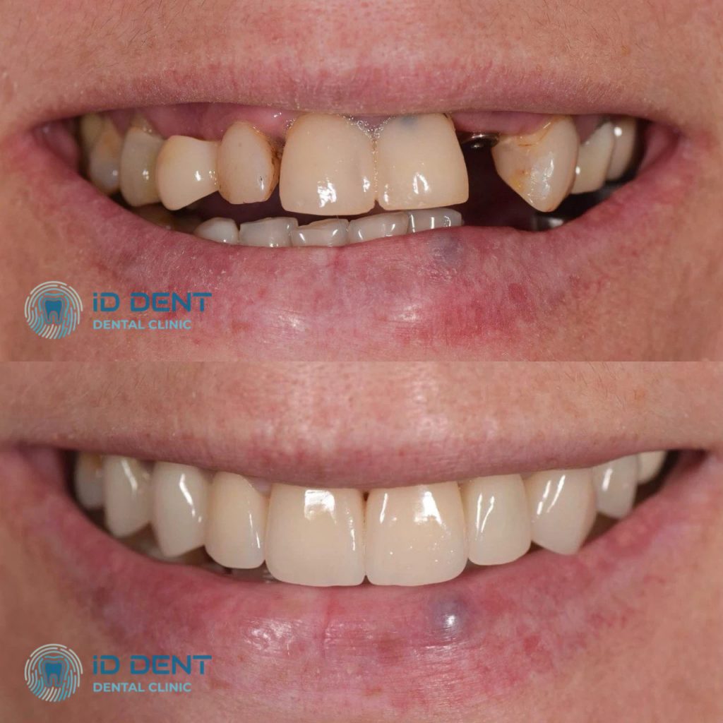 Odontólogo general; odontólogo prostodoncista Aghabekyan Andranik Vachikovich