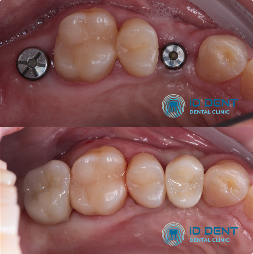 Лікар-стоматолог загального профілю; стоматолог-ортопед Агабекян Андранік Вачикович