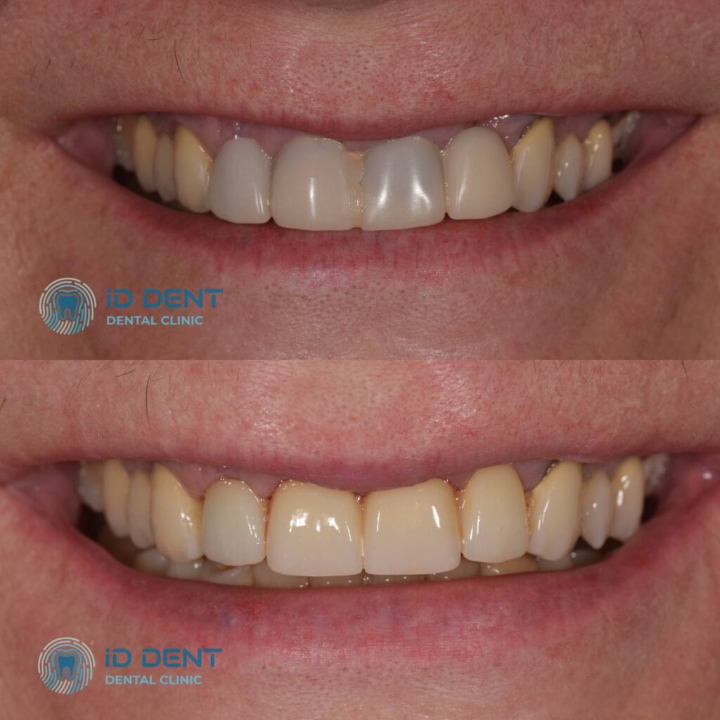 Odontólogo general; odontólogo prostodoncista Aghabekyan Andranik Vachikovich