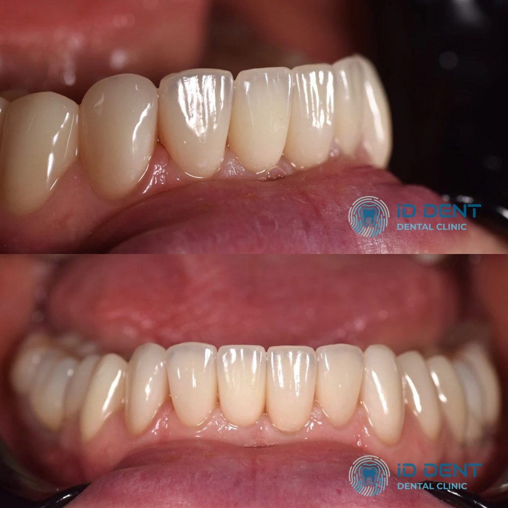 Odontólogo general; odontólogo prostodoncista Aghabekyan Andranik Vachikovich