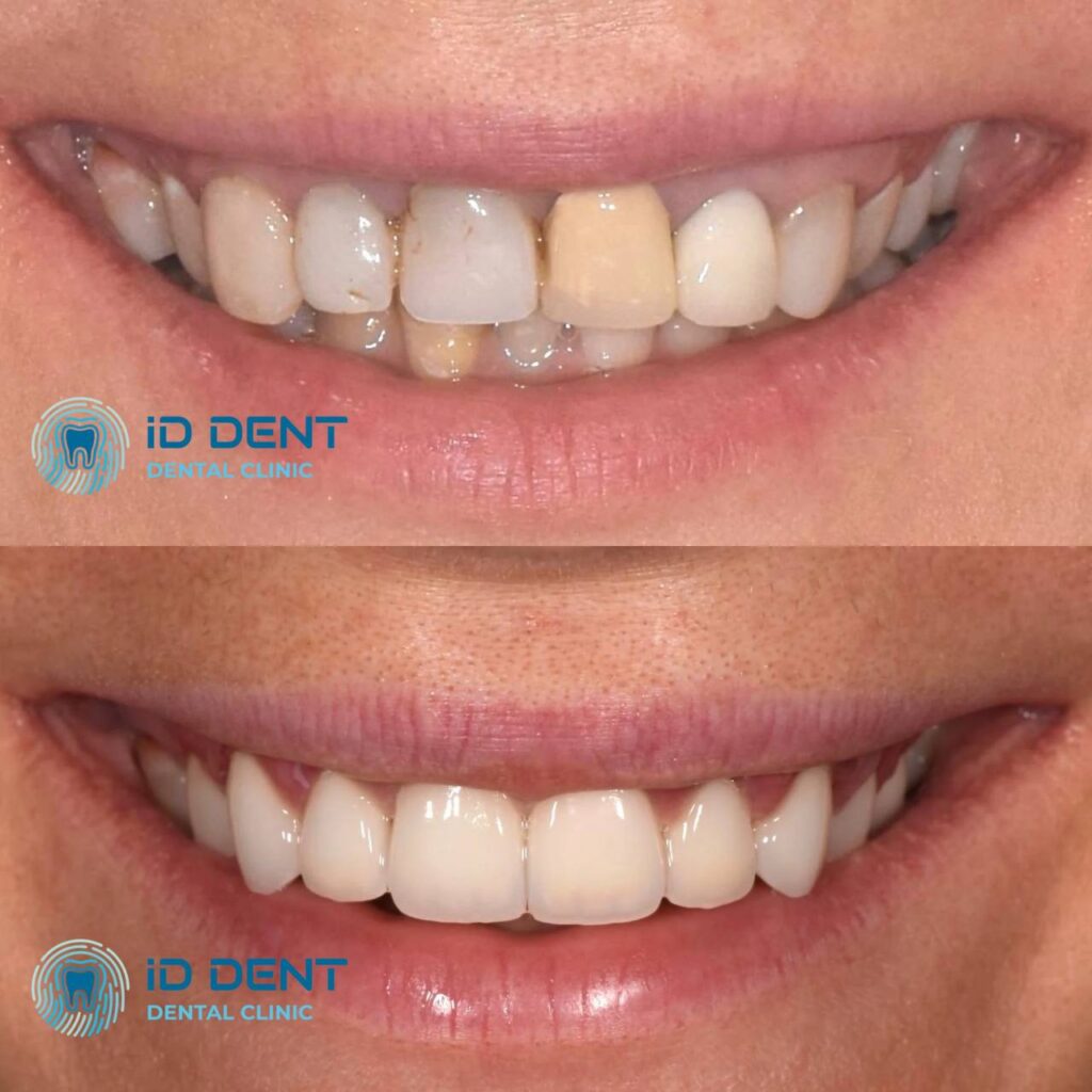 Odontólogo general; odontólogo prostodoncista Aghabekyan Andranik Vachikovich