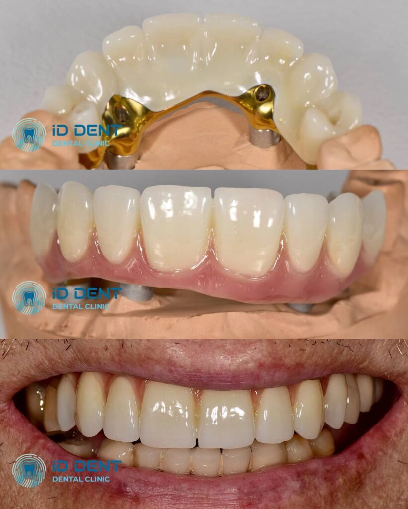 Odontólogo general; odontólogo prostodoncista Aghabekyan Andranik Vachikovich