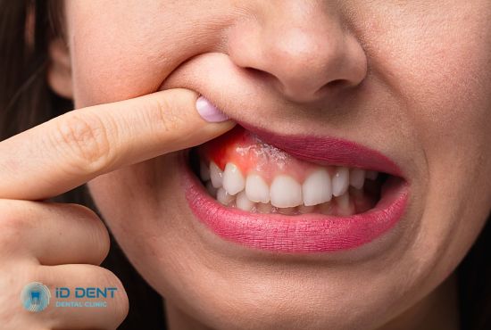 Зовнішні симптоми наявності гранулеми зуба