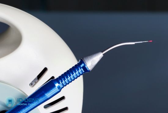 Застосування лазера в стоматології