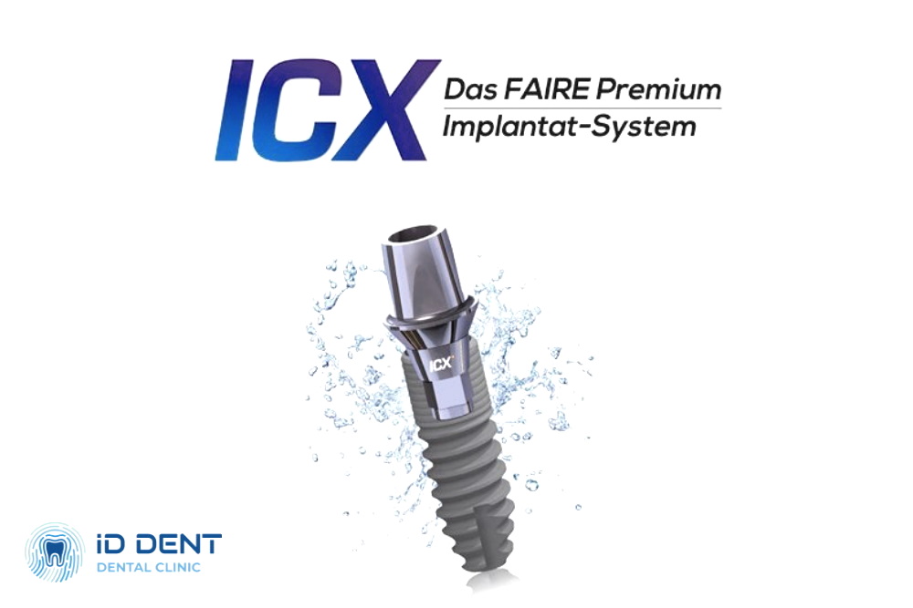 Implantes ICX Templant