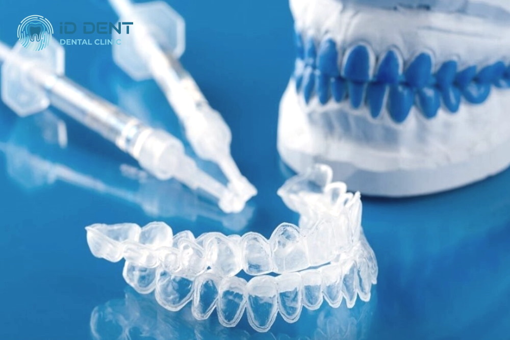  Férulas para el blanqueamiento dental