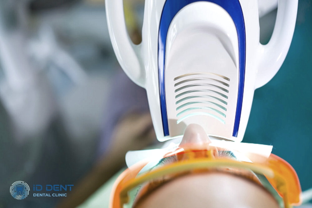  Blanqueamiento dental Beyond