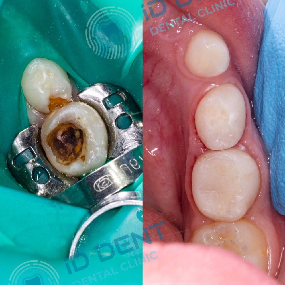 Dentista pediátrico Dzhus Tetyana Mykhailivna