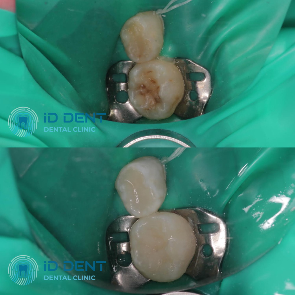 Dentista pediátrico Dzhus Tetyana Mykhailivna