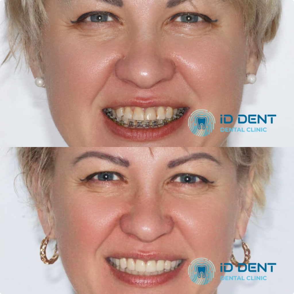 Врач-стоматолог, Ортопед Обиход Александр Андреевич