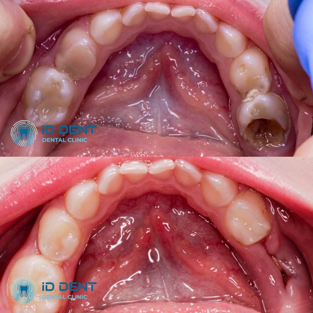 Dentista pediátrico Dzhus Tetyana Mykhailivna