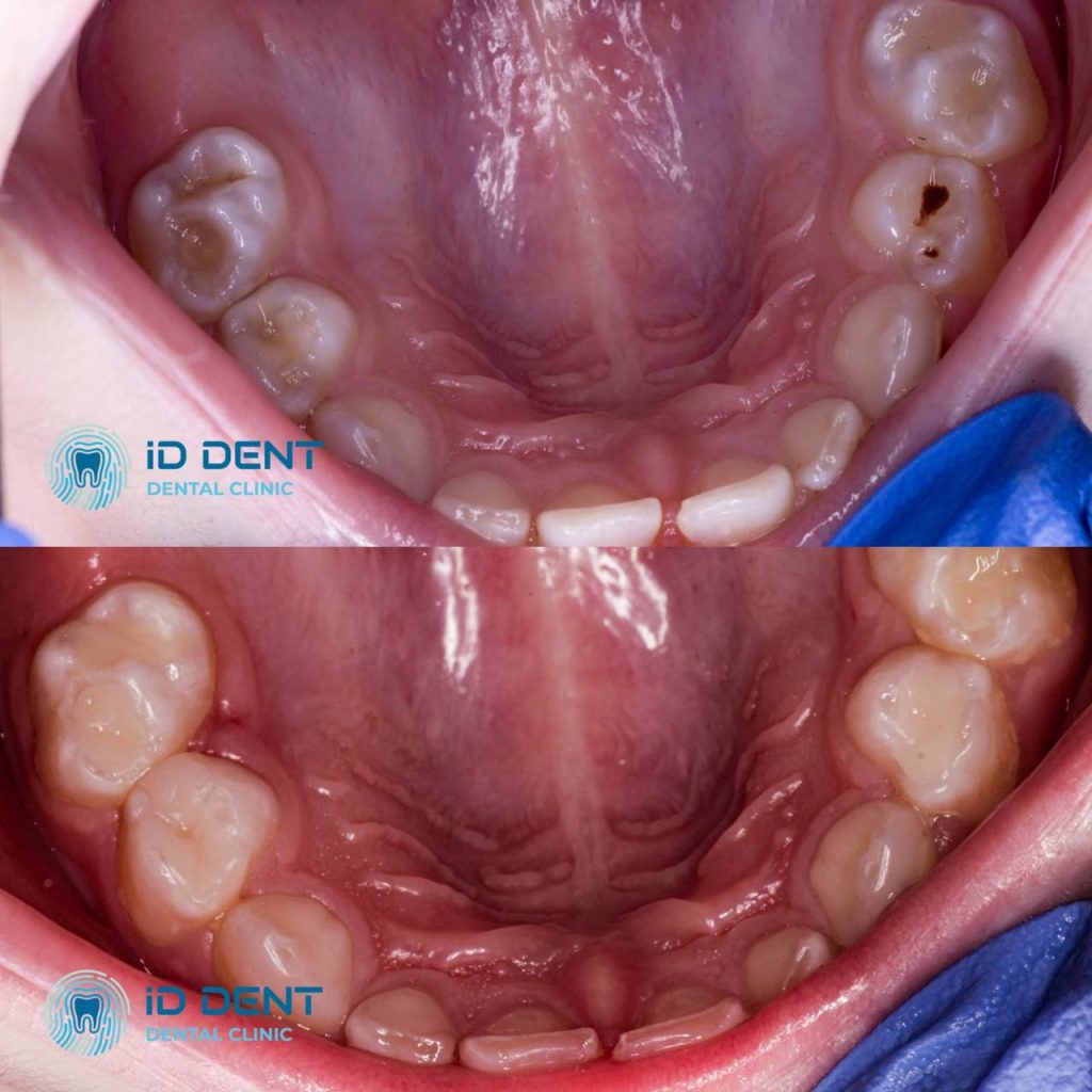 Dentista pediátrico Dzhus Tetyana Mykhailivna