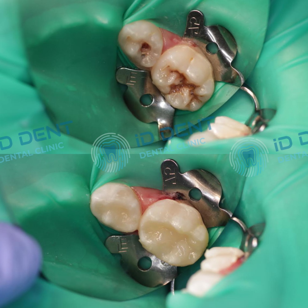 Dentista pediátrico Dzhus Tetyana Mykhailivna
