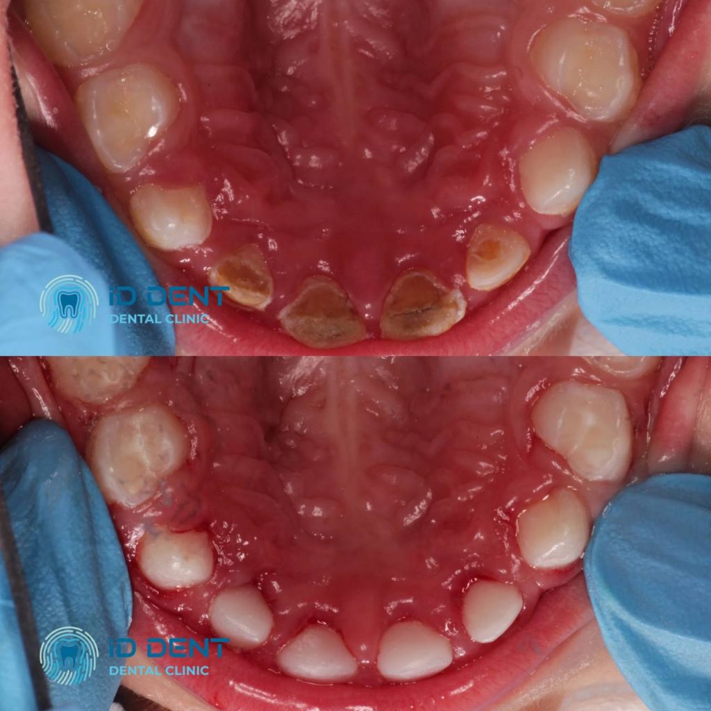 Dentista pediátrico Dzhus Tetyana Mykhailivna