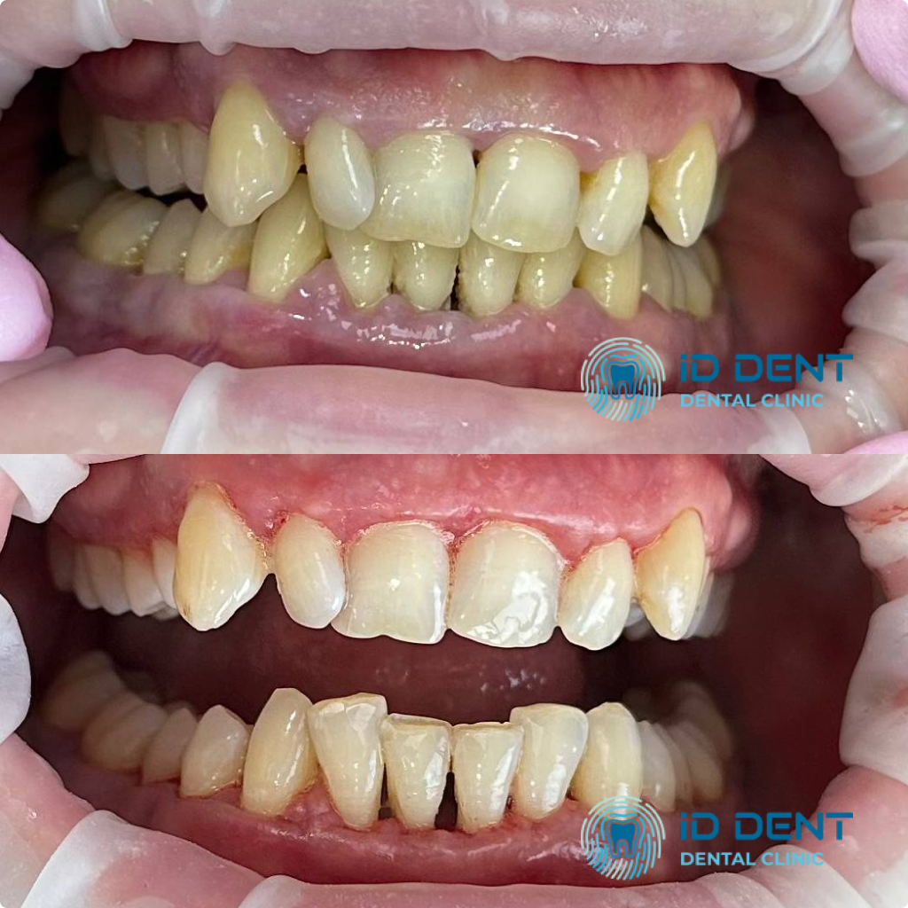 Médico dentista general; dentista higienista; periodoncista Serjovets Alina Serhiivna