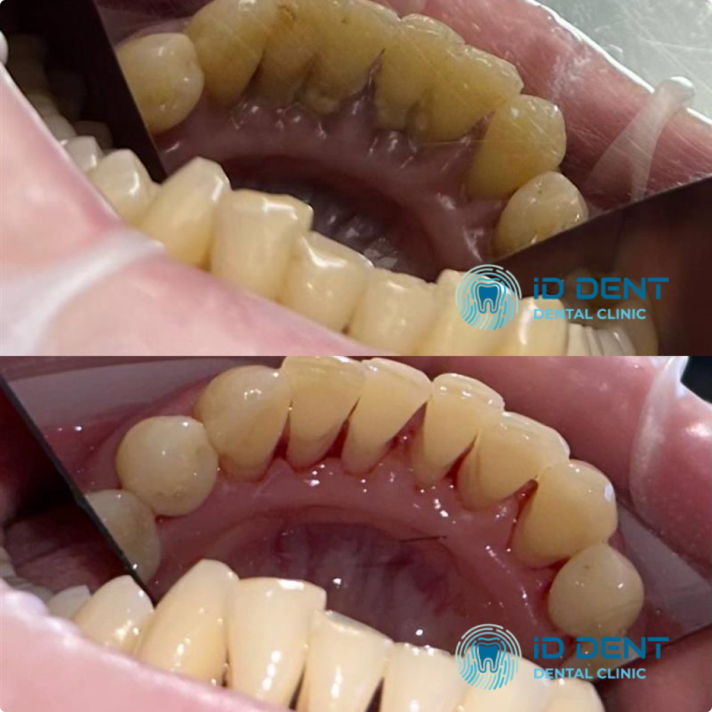Médico dentista general; dentista higienista; periodoncista Serjovets Alina Serhiivna