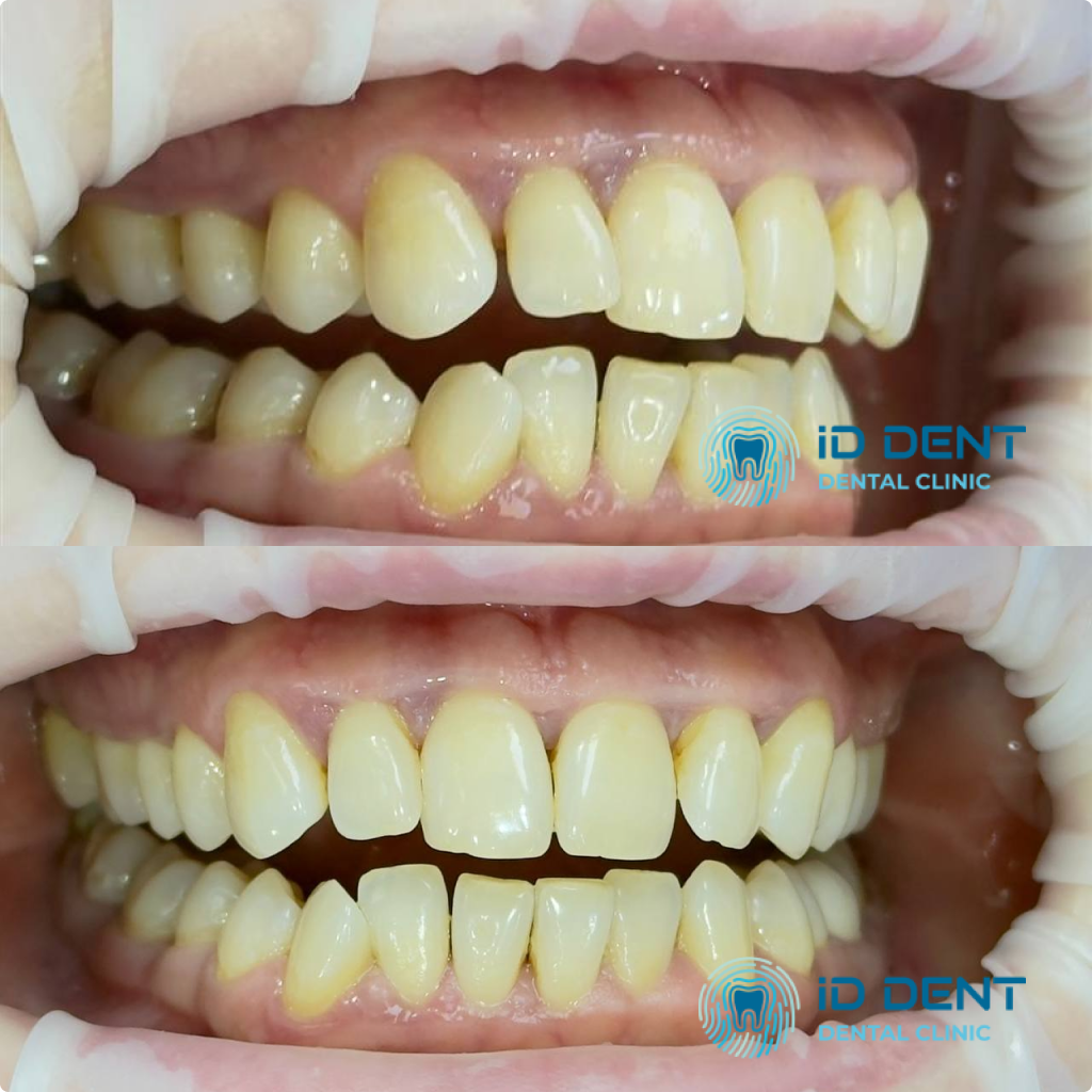 Médico dentista general; dentista higienista; periodoncista Serjovets Alina Serhiivna