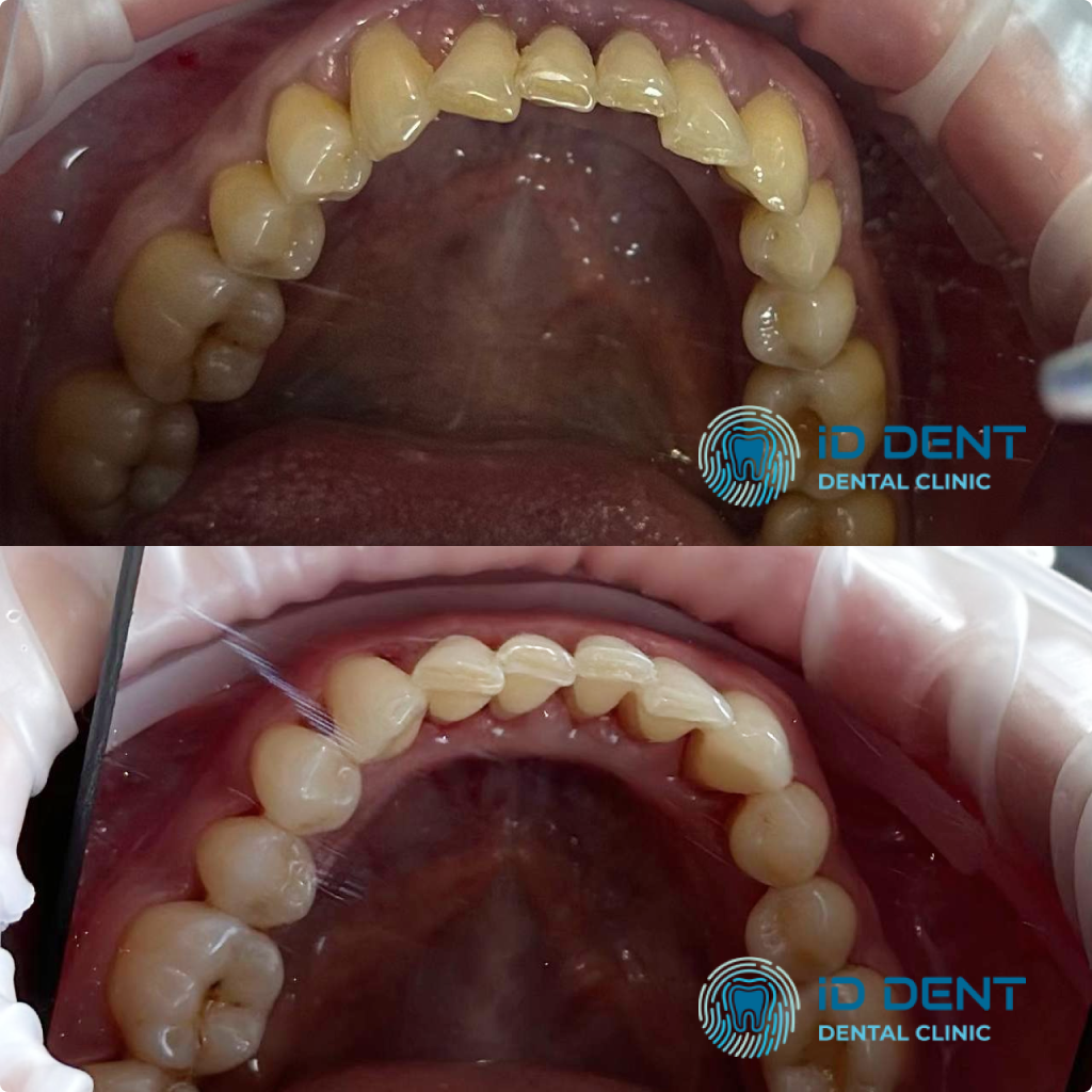 Médico dentista general; dentista higienista; periodoncista Serjovets Alina Serhiivna