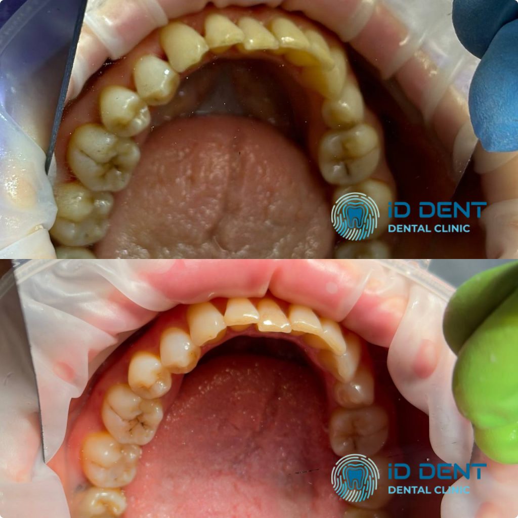 Médico dentista general; dentista higienista; periodoncista Serjovets Alina Serhiivna