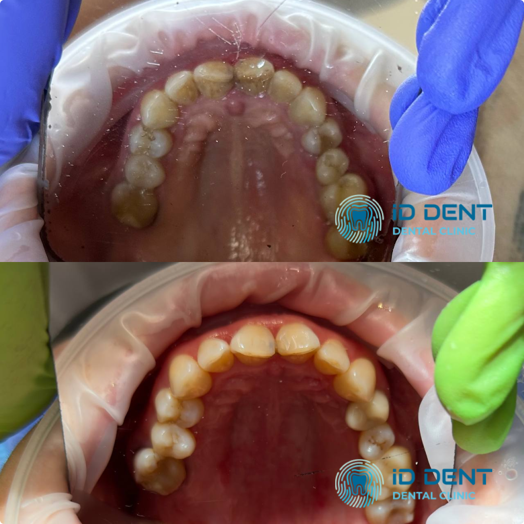 Médico dentista general; dentista higienista; periodoncista Serjovets Alina Serhiivna