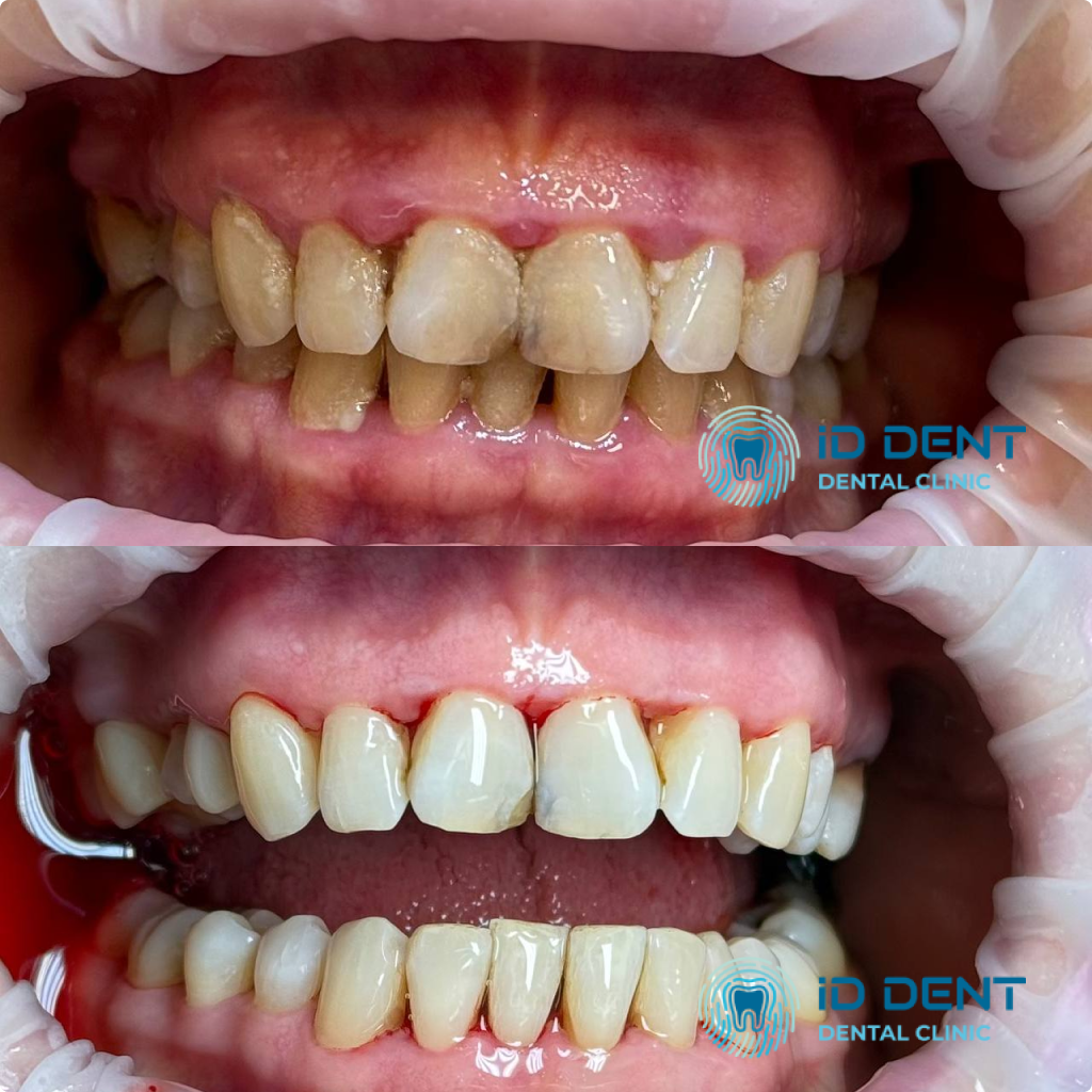 Médico dentista general; dentista higienista; periodoncista Serjovets Alina Serhiivna