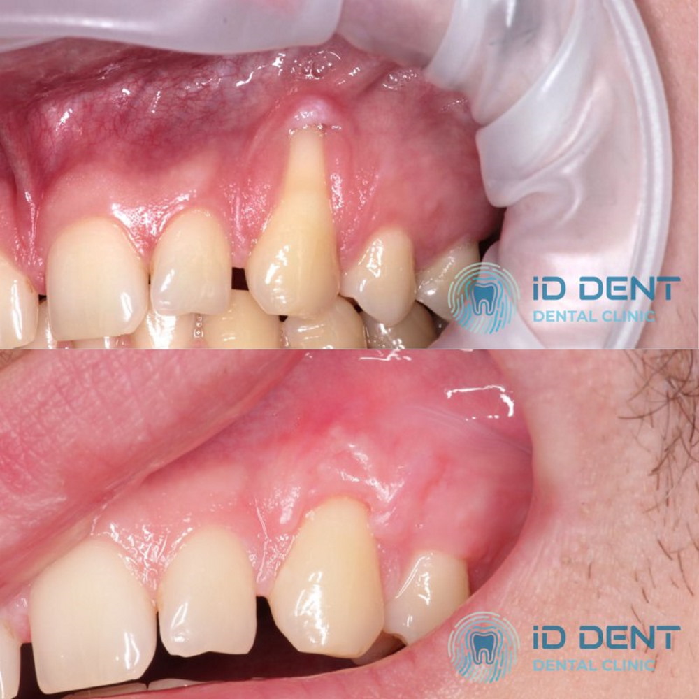 Cirujano maxilofacial, médico dentista-cirujano, médico implantólogo Keyan David Mykolaiovych