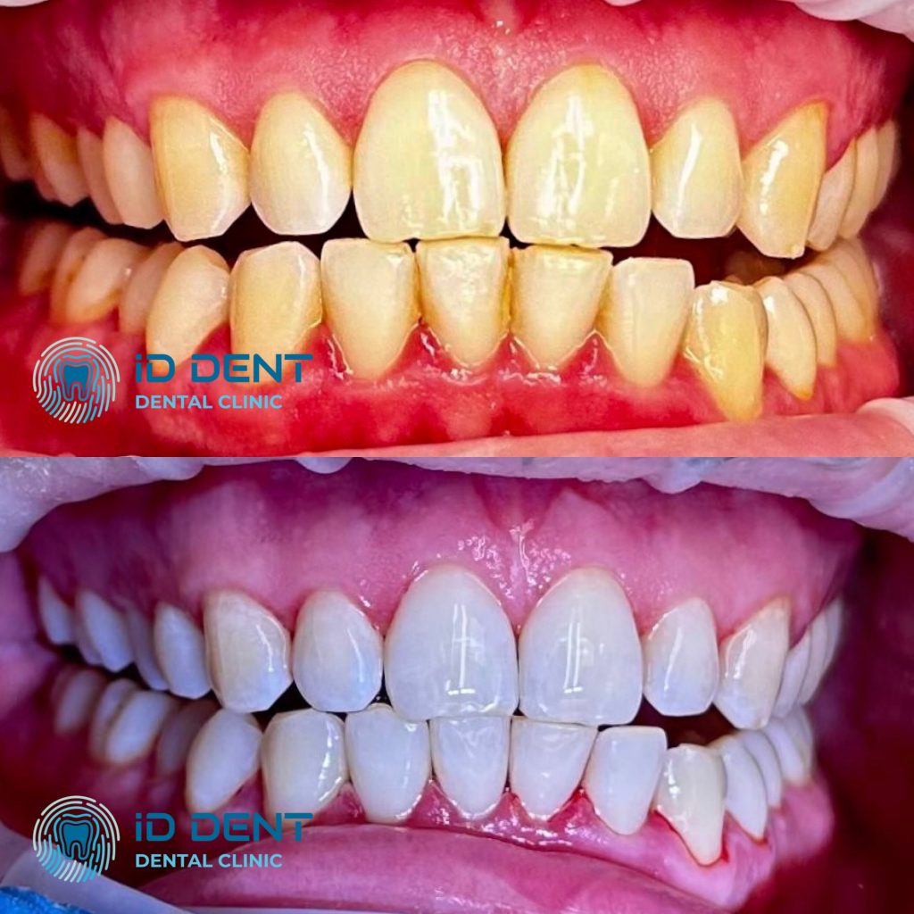 Médico dentista general; dentista higienista; periodoncista Serjovets Alina Serhiivna