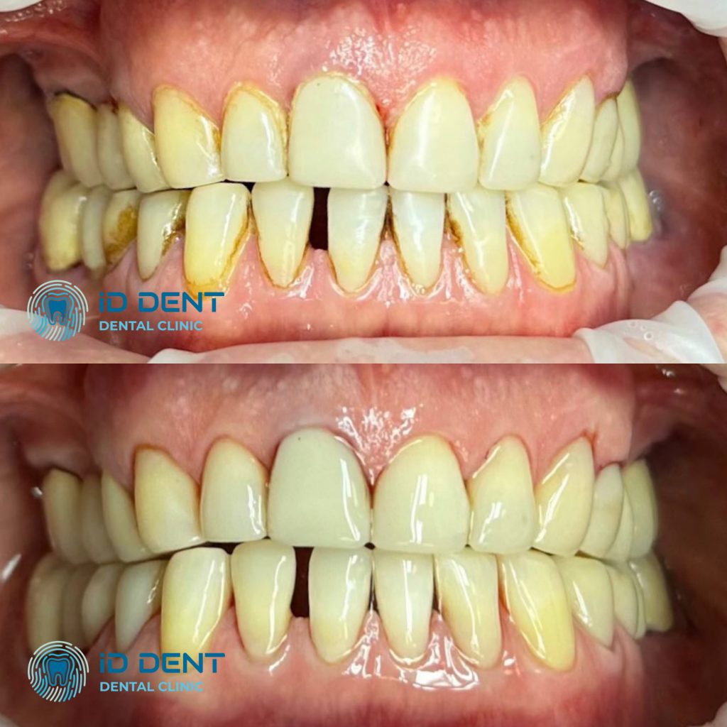 Médico dentista general; dentista higienista; periodoncista Serjovets Alina Serhiivna