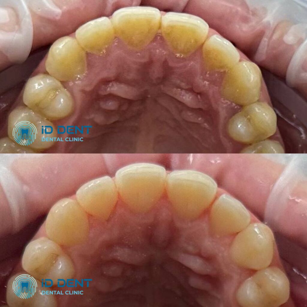 Médico dentista general; dentista higienista; periodoncista Serjovets Alina Serhiivna