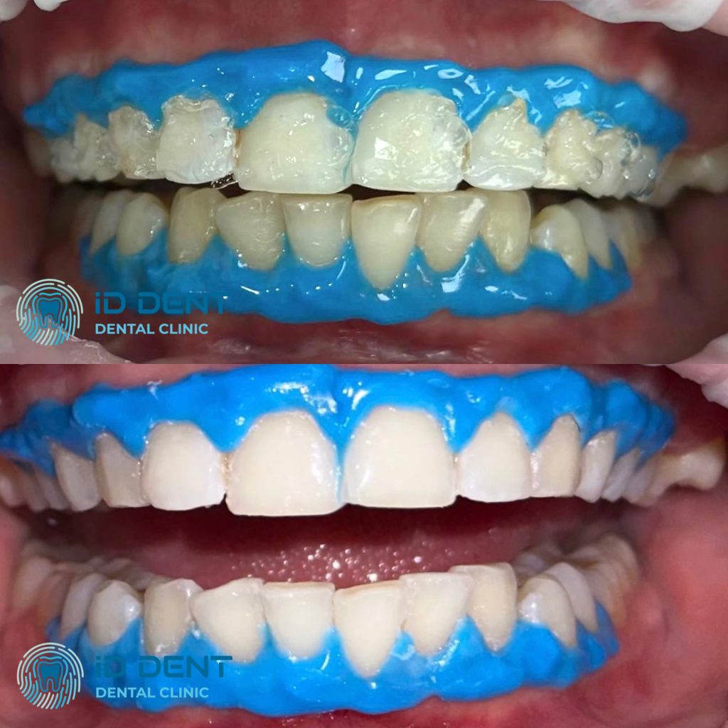 Médico dentista general; dentista higienista; periodoncista Serjovets Alina Serhiivna