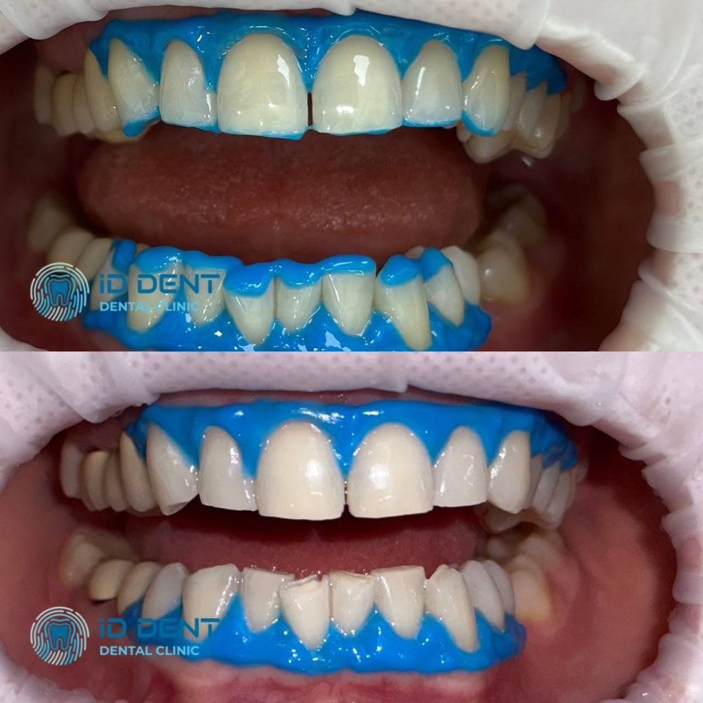 Médico dentista general; dentista higienista; periodoncista Serjovets Alina Serhiivna