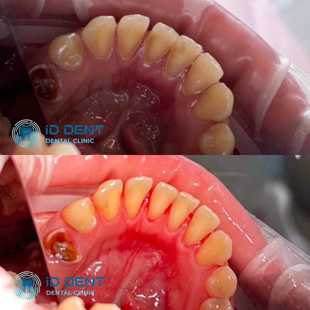 Médico dentista general; dentista higienista; periodoncista Serjovets Alina Serhiivna