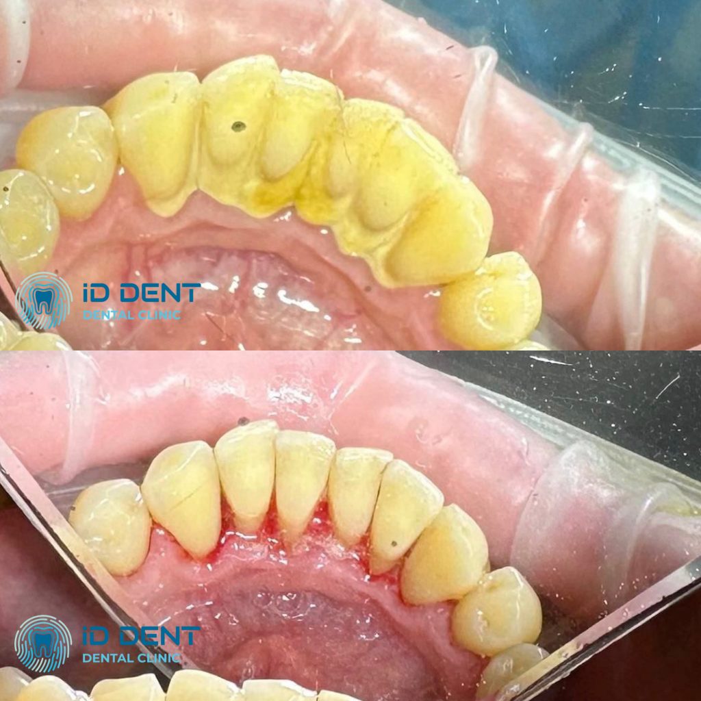 Médico dentista general; dentista higienista; periodoncista Serjovets Alina Serhiivna