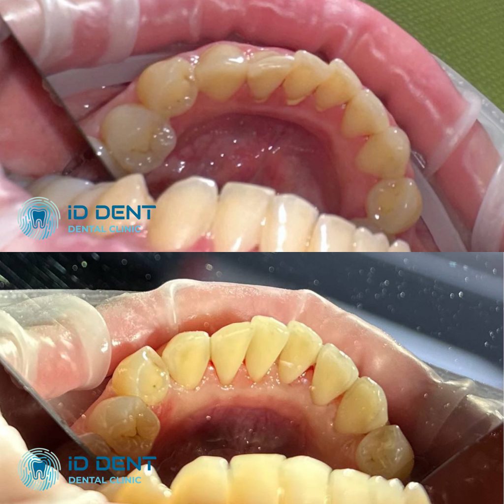 Médico dentista general; dentista higienista; periodoncista Serjovets Alina Serhiivna