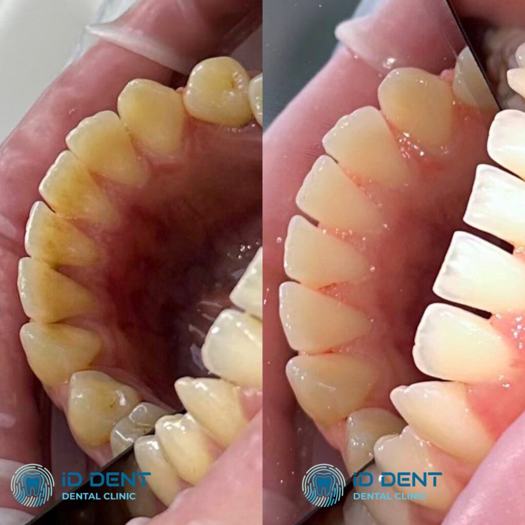 Médico dentista general; dentista higienista; periodoncista Serjovets Alina Serhiivna